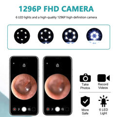 Smart Visual Ear Wax Cleaning Kit with Camera HD – Wireless Ear Cleaner Endoscope